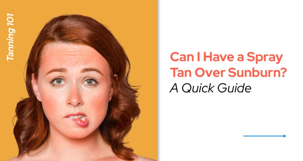 Can I Have a Spray Tan Over Sunburn? [A Quick Guide]